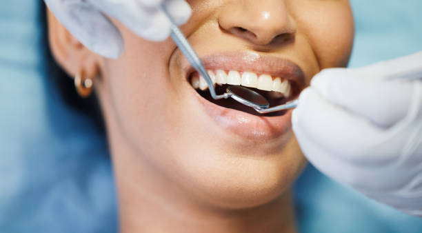 Best Broken or Chipped Tooth Repair in Watkinsville, GA